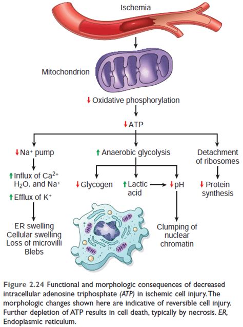 ATP depletion is a central process in pathogenesis, in particular ischaemia, hypoxia and hypoglycaemia. . Atp depletion in cell injury